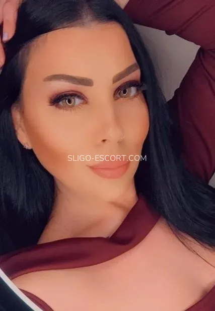 Sligo escort Allison — 9