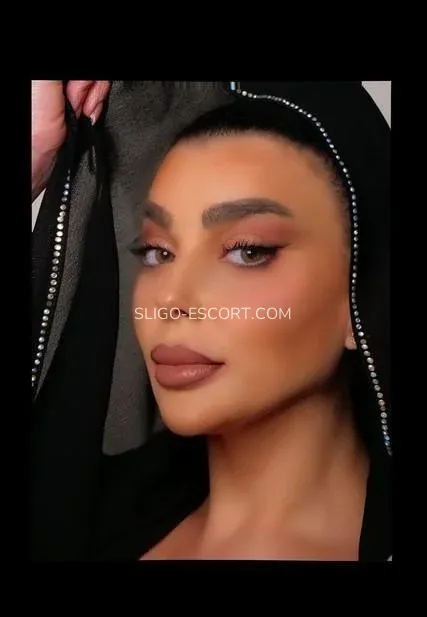 Sligo escort Allison — 4
